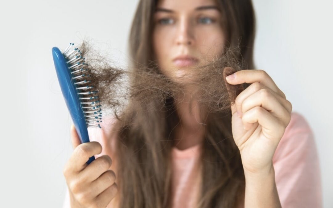 Hormones and Hair Loss